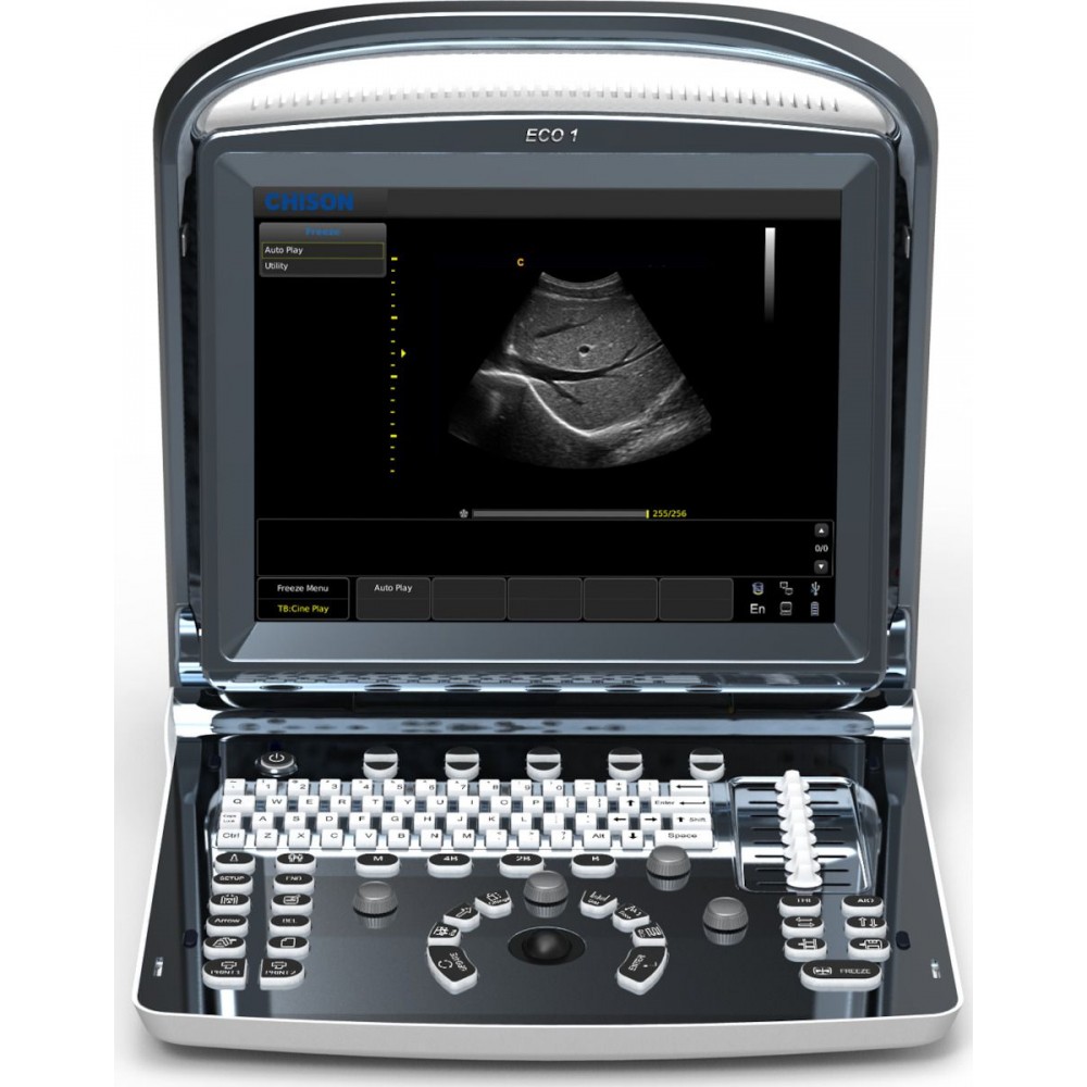 Υπέρηχος Chison Eco 1 Plus με 2 Θύρες Κεφαλής και Μπαταρία