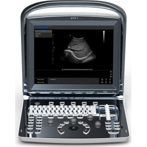 Υπέρηχος Chison Eco 1 Plus με 2 Θύρες Κεφαλής και Μπαταρία