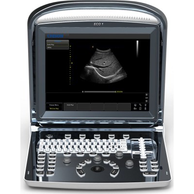 Υπέρηχος Chison Eco 1 Plus με 2 Θύρες Κεφαλής και Μπαταρία