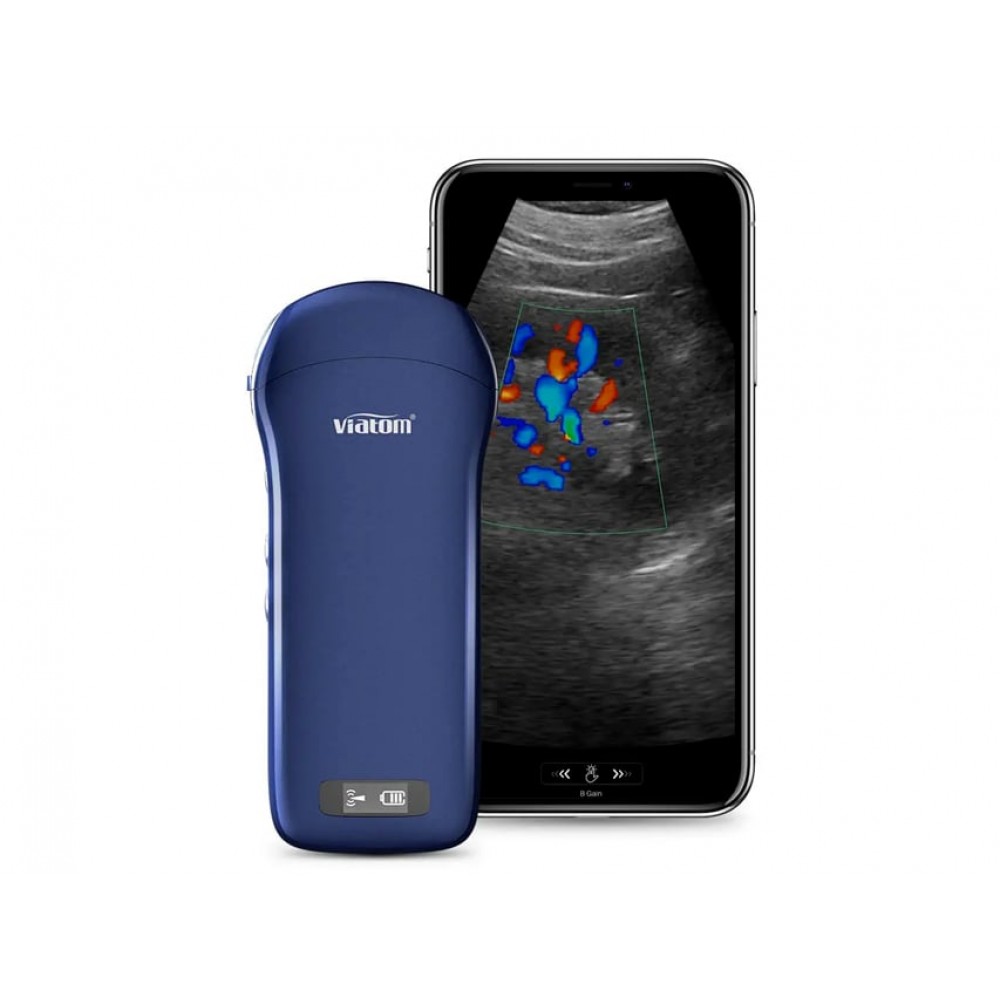 Υπέρηχος Χειρός 3 σε 1 Linear/Convex/Cardiac Ασύρματος Viatom C10