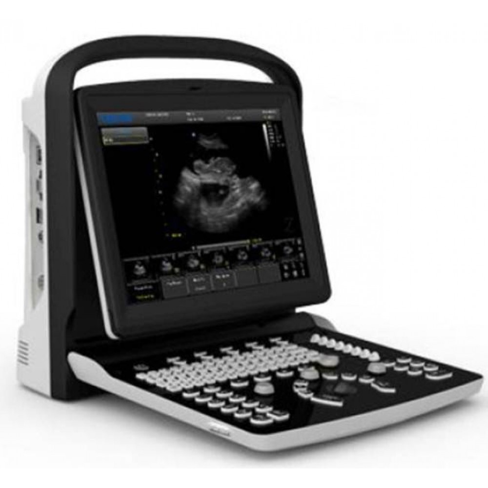 Κτηνιατρικός Ασπρόμαυρος Υπερηχοτομογράφος Eco1 Vet Chison