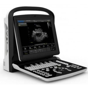 Κτηνιατρικός Ασπρόμαυρος Υπερηχοτομογράφος Eco1 Vet Chison