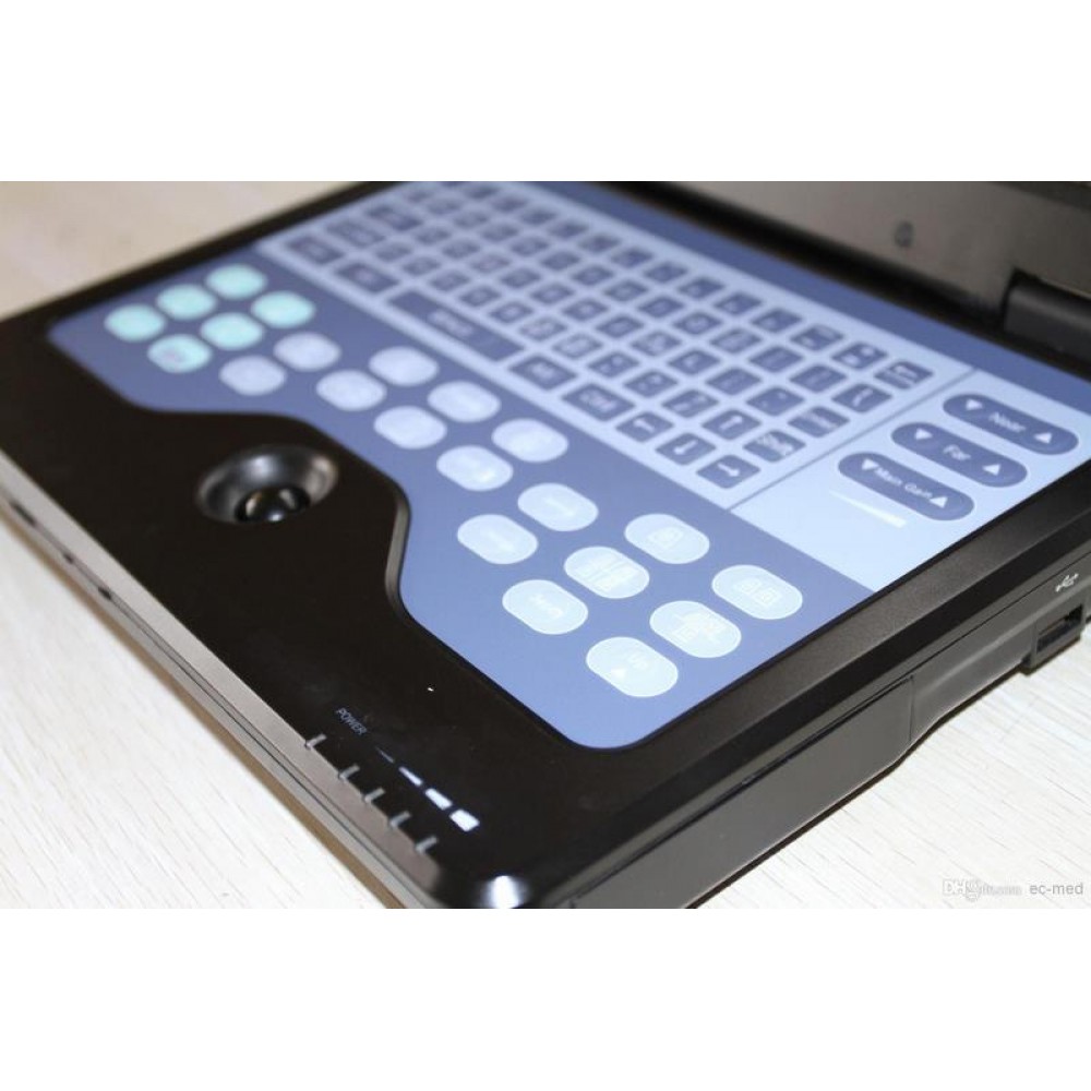 Υπέρηχος Contec 600P2 με Κεφαλή Convex, Τσάντα Μεταφοράς και Μπαταρία