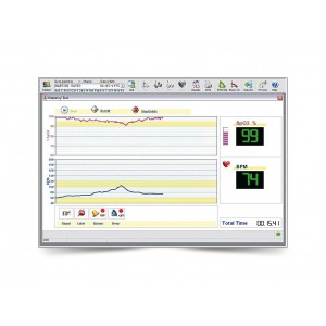 Σπιρόμετρο Spirolab MIR με SpO2 και Τουρμπίνα Πολλαπλών Χρήσεων