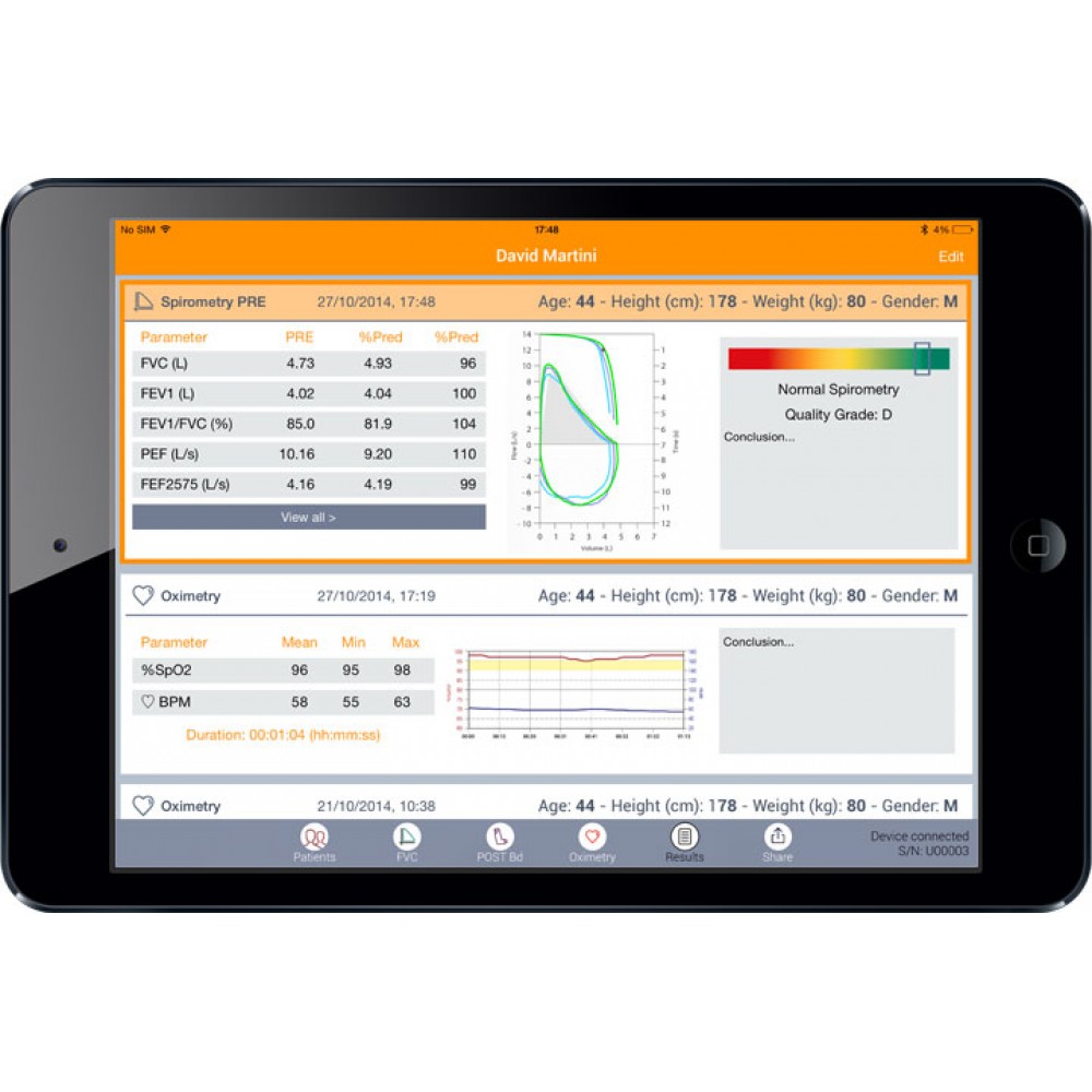 Σπιρόμετρο Spirobank II Smart MIR με SpO2 και 60 Τουρμπίνες ΜΧ FlowMir