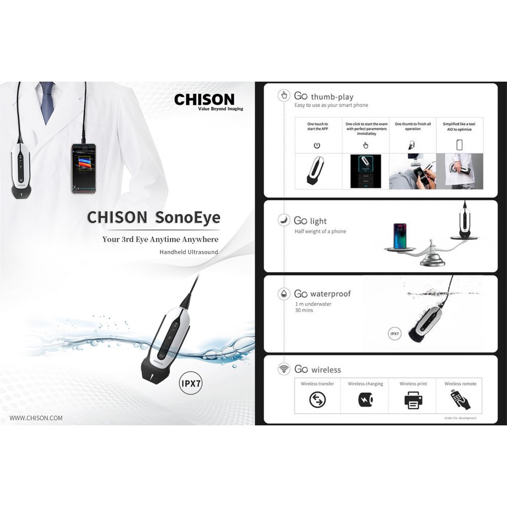 Υπέρηχος Χειρός Ασύρματος SonoEye P1-P6 Chison