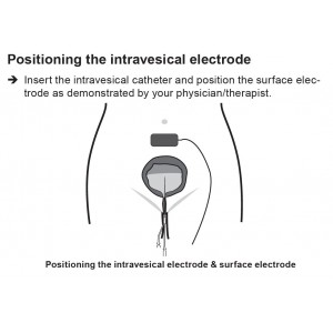 Θεραπευτικό Σύστημα SaneoCare TicMed Γερμανίας (ακράτεια)