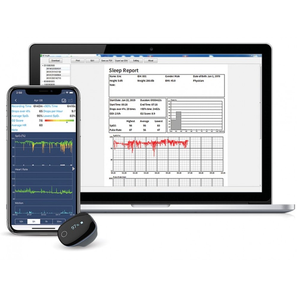 Οξύμετρο Συνεχής και Ζωντανής Παρακολούθησης Ενηλικών O2Ring Viatom