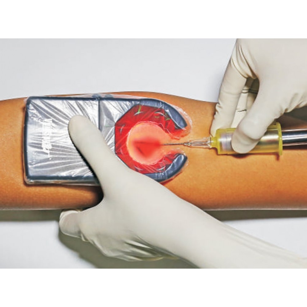 Ανιχνευτής Φλεβών Veinspy Tulip Diagnostics