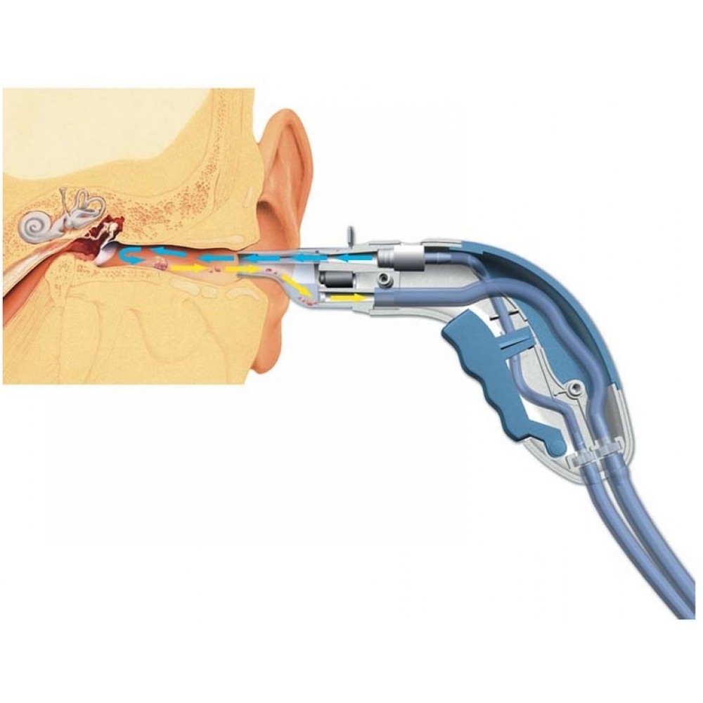 Σύστημα πλύσης αυτιών Ear Wash Welch Allyn