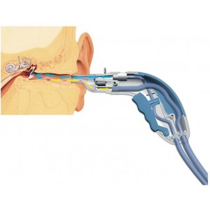 Σύστημα πλύσης αυτιών Ear Wash Welch Allyn