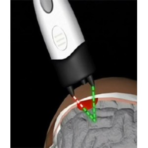 Φορητή συσκευή εντοπισμού ενδοκρανιακού αιματώματος InfraScanner InfraScan