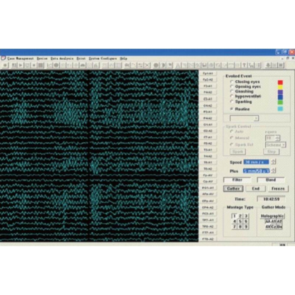 Εγκεφαλογράφος KT88-3200 Contec