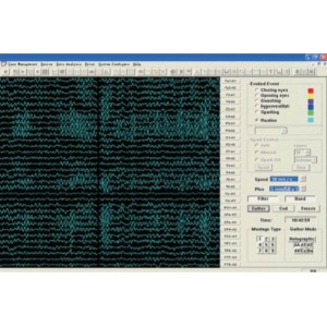 Εγκεφαλογράφος KT88-3200 Contec