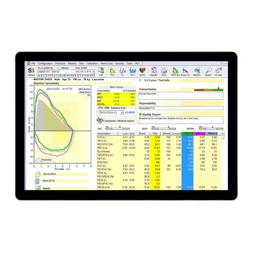 Σπιρόμετρο Minispir MIR με 60 Τουρμπίνες ΜΧ FlowMir