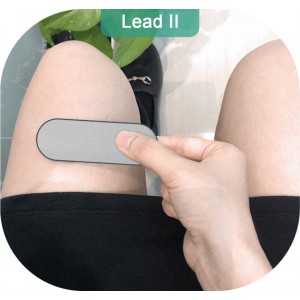 Φορητή Συσκευή Ηλεκτροκαρδιογραφήματος DuoEK Wellue