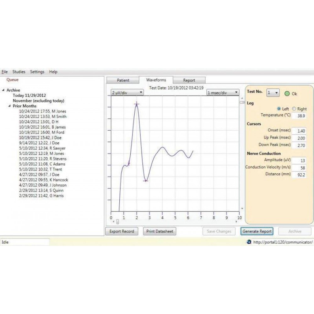 Συσκευή διάγνωσης περιφερικής διαβητικής νευροπάθειας NC-stat DPNCheck NeuroMetrix