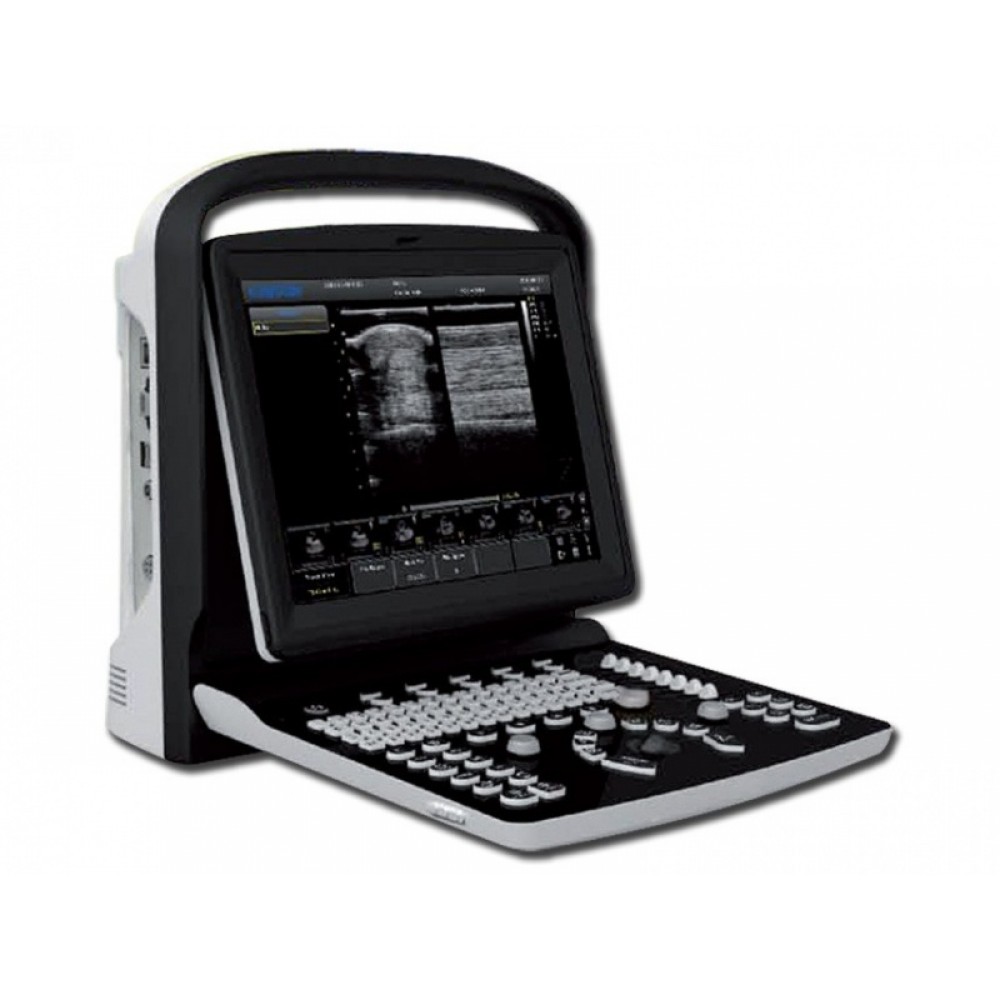 Υπέρηχος Chison Eco 1 Plus με 2 Θύρες Κεφαλής και Μπαταρία