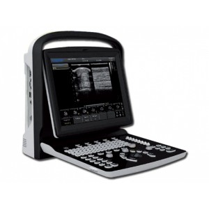 Υπέρηχος Chison Eco 1 Plus με 2 Θύρες Κεφαλής και Μπαταρία