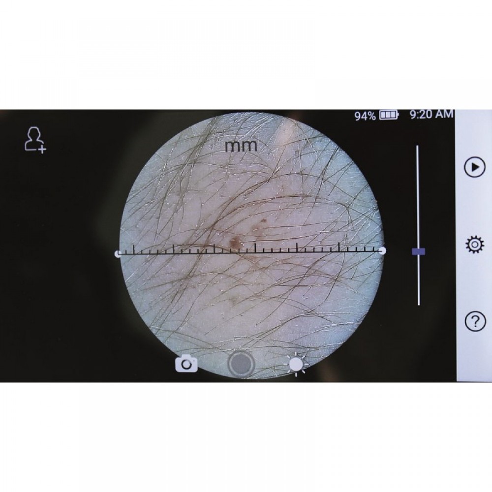 Ιατρική Κάμερα Πολλαπλών Εφαρμογών RCS-100 Camera Riester