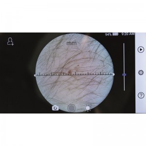 Ιατρική Κάμερα Πολλαπλών Εφαρμογών RCS-100 Camera Riester