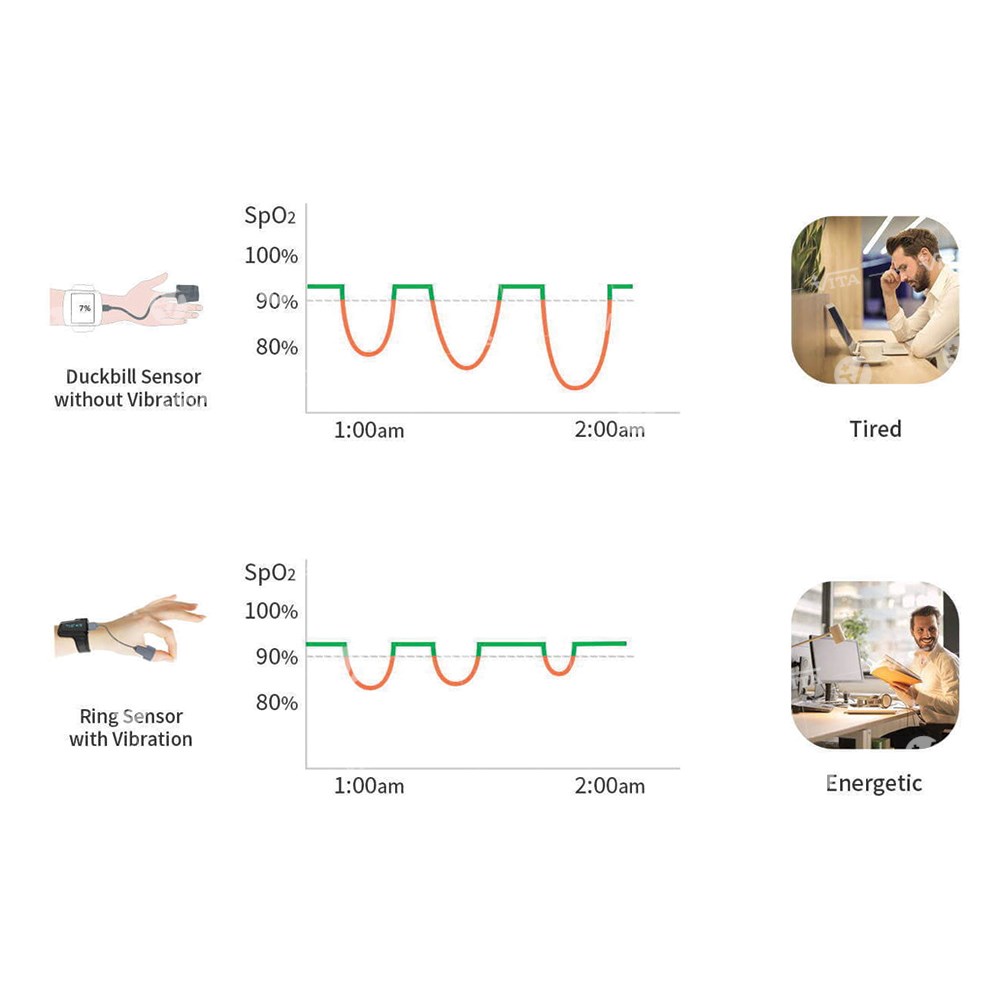 Οξύμετρο Καρπού Monitor Checkme O2 Viatom