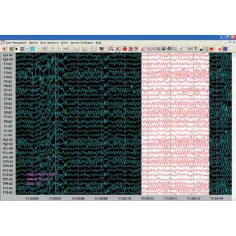 Εγκεφαλογράφος KT88-3200 Contec