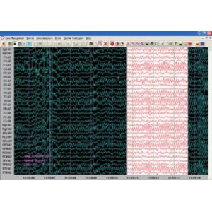 Εγκεφαλογράφος KT88-3200 Contec