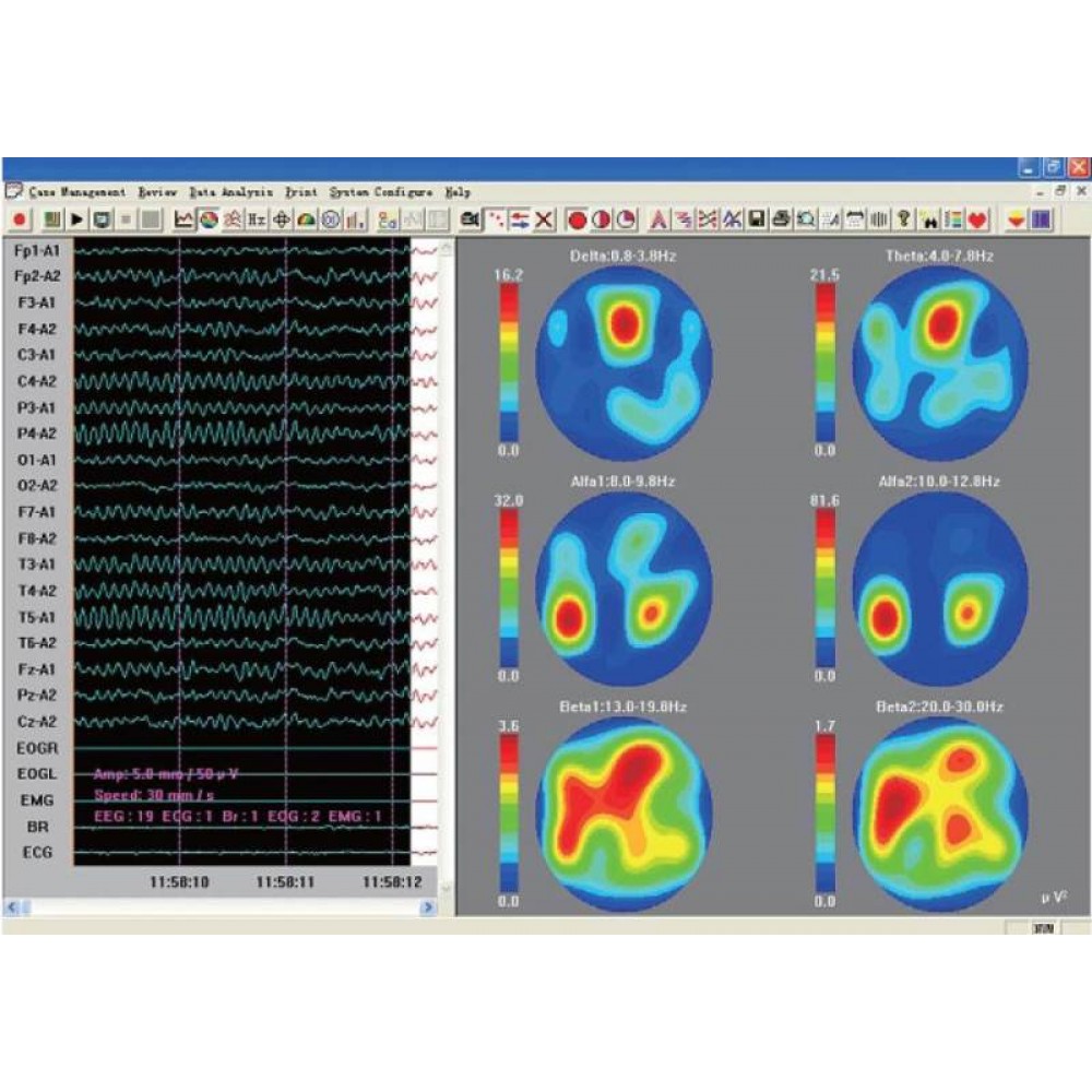 Εγκεφαλογράφος KT88-2400 Contec