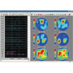 Εγκεφαλογράφος KT88-2400 Contec