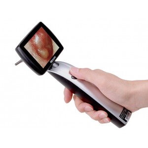 Ωτοσκόπιο Με Οθόνη MS102 πλήρης έκδοση Elite Pack MD Scope