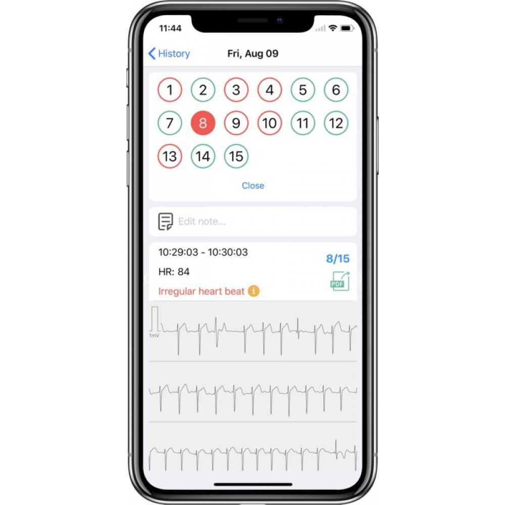 Φορητή Συσκευή Ηλεκτροκαρδιογραφήματος DuoEK Wellue