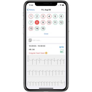 Φορητή Συσκευή Ηλεκτροκαρδιογραφήματος DuoEK Wellue