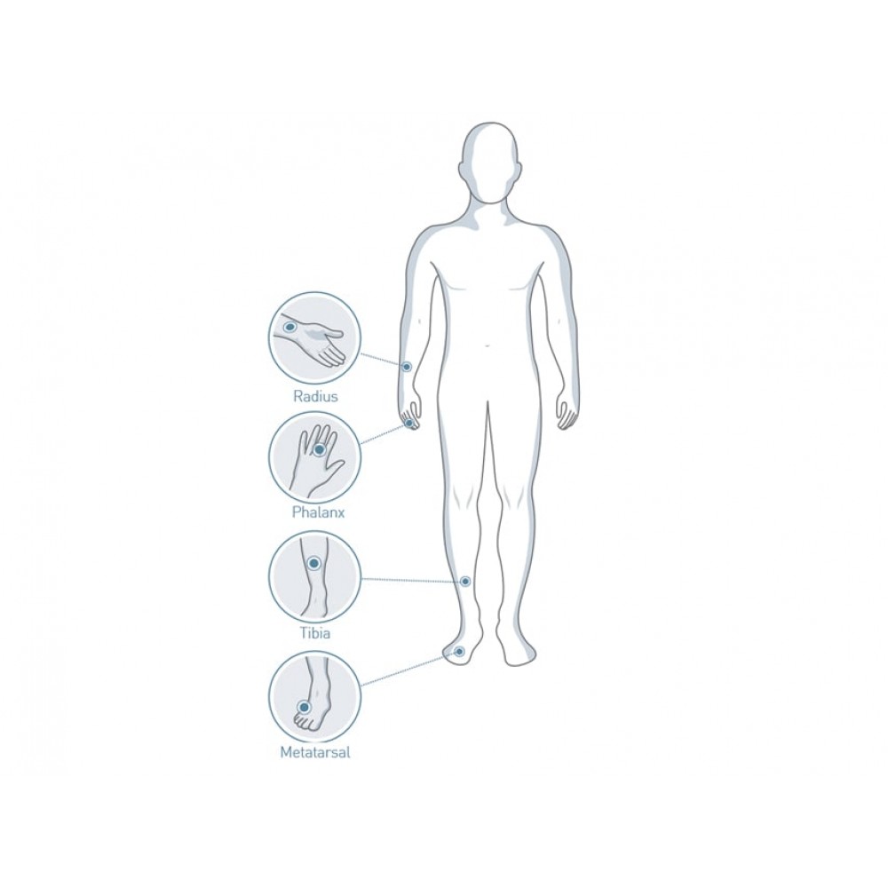 Μετρητής Οστικής Πυκνότητας Sunlight MiniOmni BeamMed