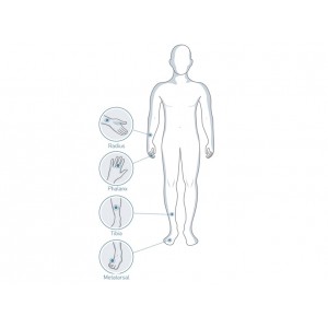 Μετρητής Οστικής Πυκνότητας Sunlight MiniOmni BeamMed