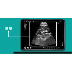 Υπέρηχος Χειρός 3 σε 1 Linear/Convex/Cardiac Ασύρματος Viatom C10