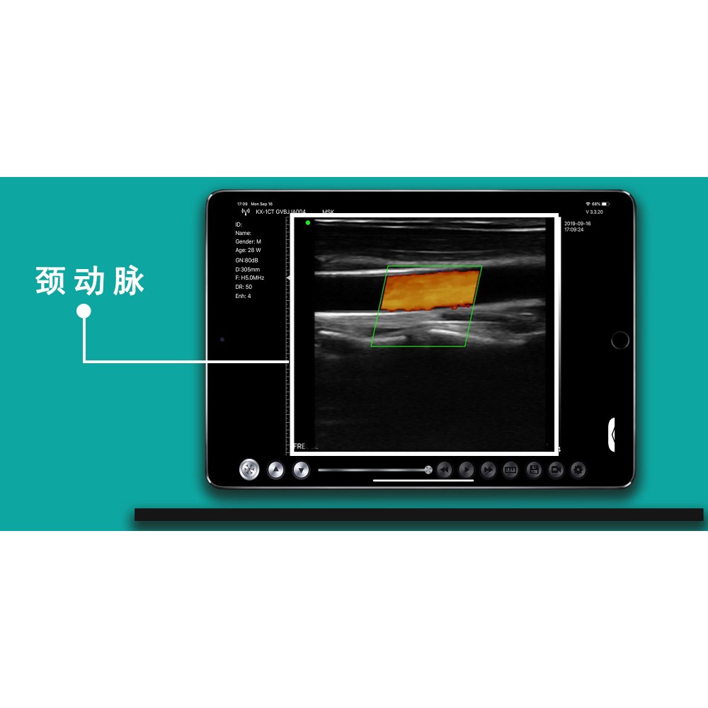 Υπέρηχος Χειρός 3 σε 1 Linear/Convex/Cardiac Ασύρματος Viatom C10
