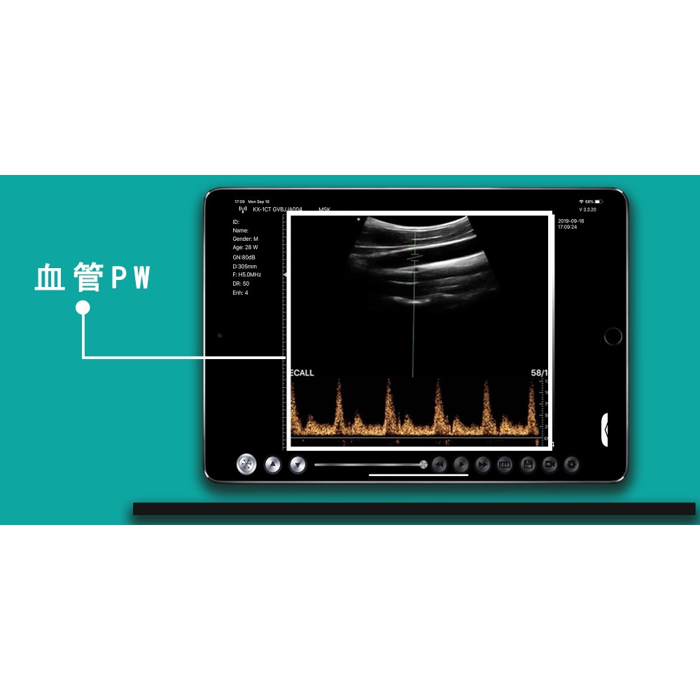 Υπέρηχος Χειρός 3 σε 1 Linear/Convex/Cardiac Ασύρματος Viatom C10