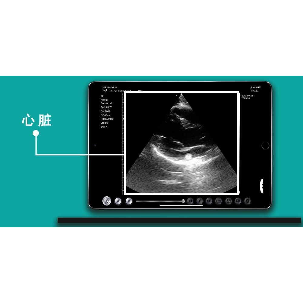 Υπέρηχος Χειρός 3 σε 1 Linear/Convex/Cardiac Ασύρματος Viatom C10