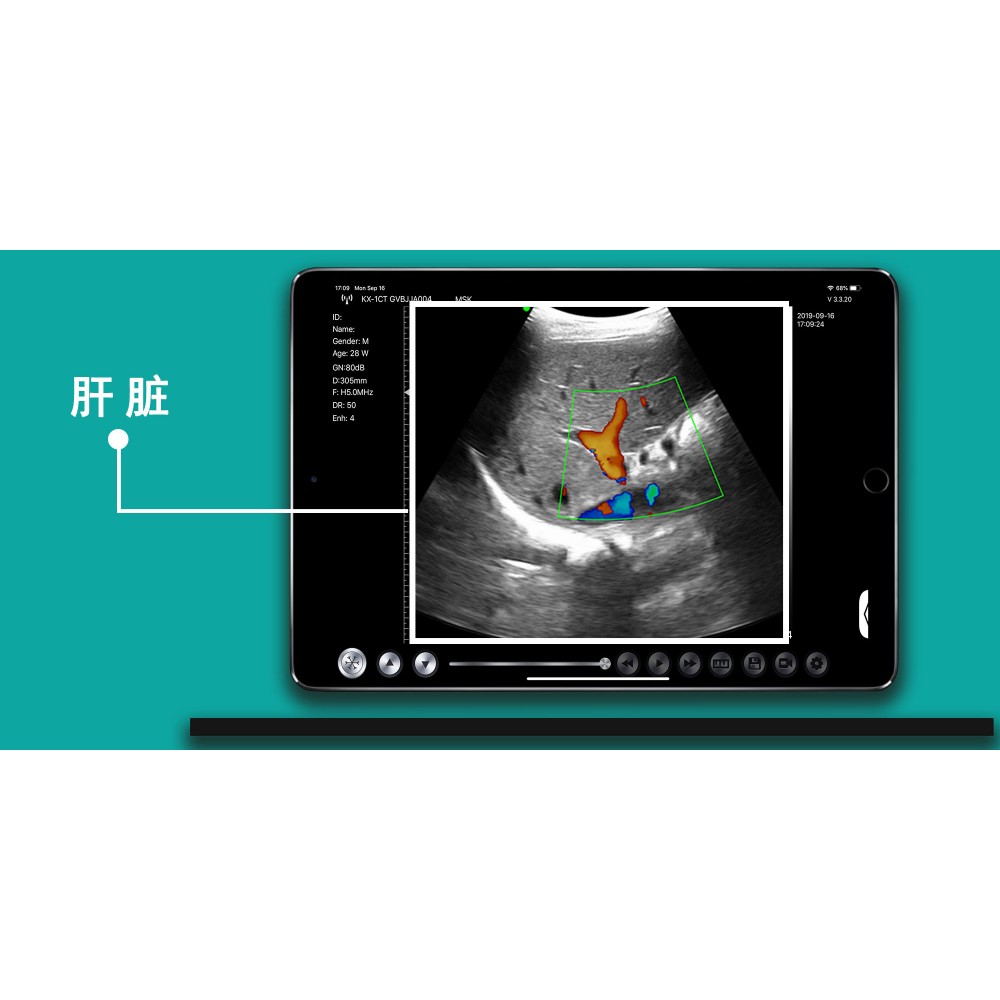 Υπέρηχος Χειρός 3 σε 1 Linear/Convex/Cardiac Ασύρματος Viatom C10