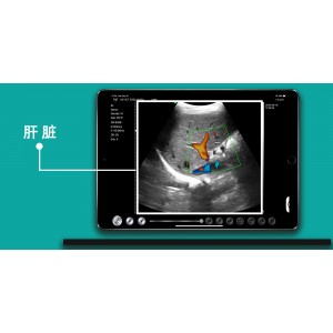 Υπέρηχος Χειρός 3 σε 1 Linear/Convex/Cardiac Ασύρματος Viatom C10