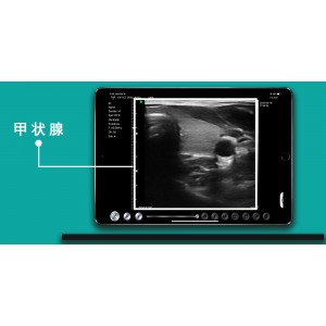 Υπέρηχος Χειρός 3 σε 1 Linear/Convex/Cardiac Ασύρματος Viatom C10