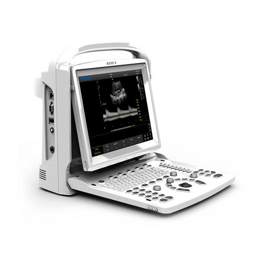 Υπέρηχος Chison Eco 3 με Doppler και Μπαταρία