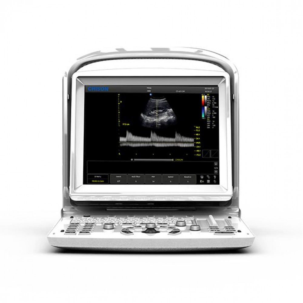 Υπέρηχος Chison Eco 3 με Doppler και Μπαταρία