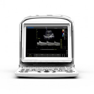 Υπέρηχος Chison Eco 3 με Doppler και Μπαταρία