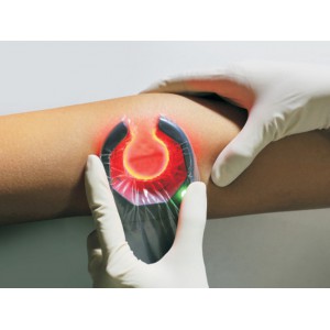 Ανιχνευτής Φλεβών Veinspy Tulip Diagnostics Μηχανήματα
