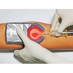 Ανιχνευτής Φλεβών Veinspy Tulip Diagnostics Μηχανήματα